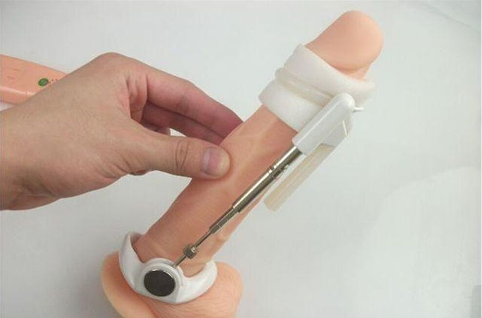 extender pro zvětšení penisu